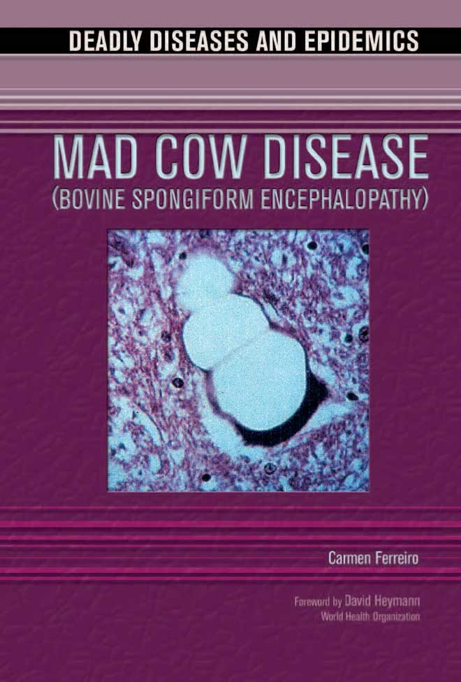 Mad Cow Disease (Bovine Spongiform  Encephalopathy)
