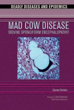 Mad Cow Disease (Bovine Spongiform  Encephalopathy)
